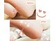 アベビー(Abeby)の写真