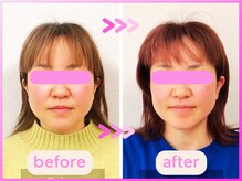 ホリハ整体院/*Before&After* 美顔デザイン