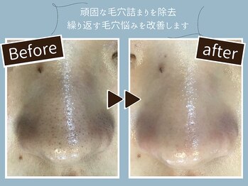 イーヴィックサカエ(E-vik Sakae)