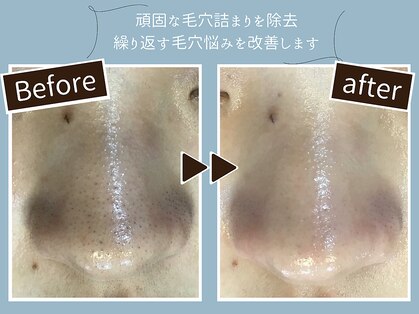 イーヴィックサカエ(E-vik Sakae)の写真