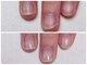寺子屋ビューティーズ(寺子屋Beauty's)の写真/巻き爪も深爪もお任せ！爪のお悩みを解消しつつ、見せる足元のフットネイルが楽しめるサロンです★