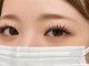 アルセ(Arce)の写真
