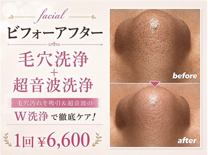 なちゅら(Nachula)の写真