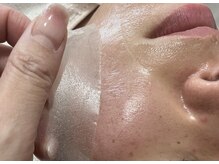 エクスクラメーションマーク(!!!)/水光人工皮膜