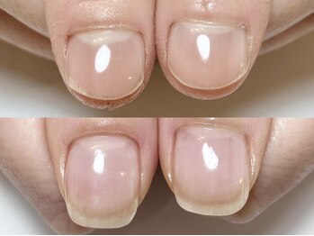 プラスミー(+me)の写真/＼ピンクの部分が小さくて悩んでる方の為のメニュー／健康で美しい縦長なお爪になれます。