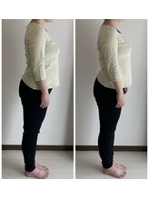 イルソーレ(IL Sole)/美シルエット骨格矯正