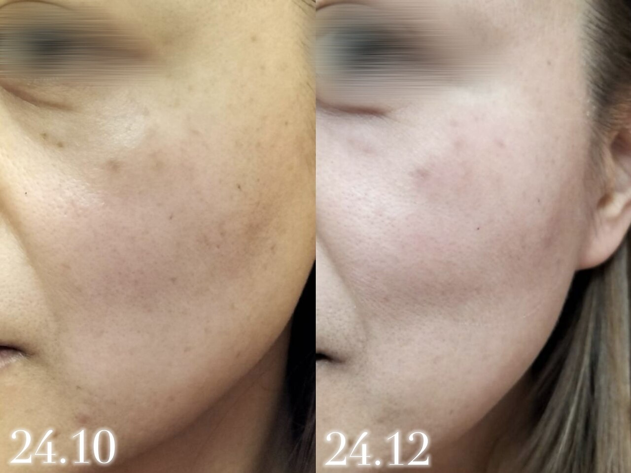 ハーブピーリングbeauty page1 楽天市場】クレンジング 菅貞子ハーブピーリングシリーズ