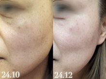 ツグ(tsugu.)の雰囲気（Dr.PURシミ改善プログラム◎肌全体が綺麗になる人気の肌質改善！）