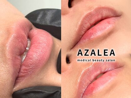 アザレア(Azalea)の写真