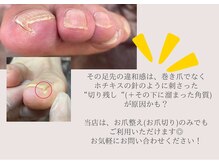 ビビィ(vivie)の雰囲気（その違和感、爪の切り方のせいかも...お悩み、お聞かせください）
