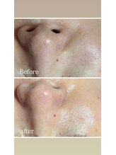 リンカ(Rinca)/綺麗！