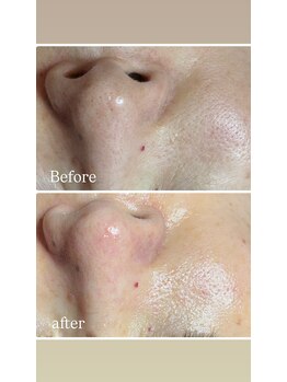 リンカ(Rinca)/綺麗!