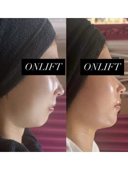 マヤヒメ(mayahime)/オンダリフト