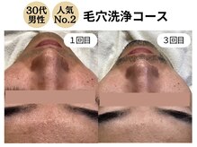 ディレイア ザ コスメ 有楽町マルイ店(direia the cosme)/メンズ/月１回/［有楽町］