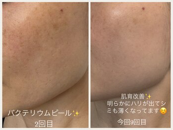 グランボヌール(grand bonheur)/【バクテリウムピール】