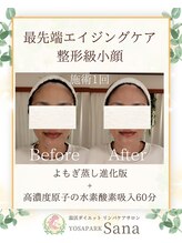 ヨサパーク サーナ 仙川(YOSA PARK Sana)/40代お客様ビフォーアフター
