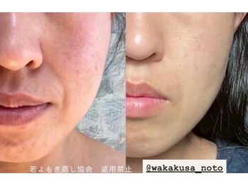 リレフー(Relafy)/★美肌★30代 女性