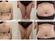 レスプロンディール(Resplendir)の写真