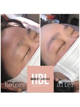 カイリ(Kaire)/ハリウッドブロウリフト