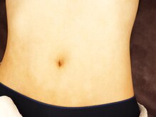 リムーブ(REMOVE)/全身脱毛も無理なく通える◎