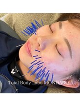 モンダロ(MONDARO)/美容鍼