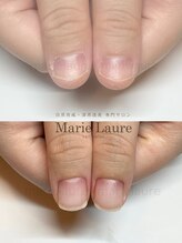 マリーロール 淀屋橋本店(Marie Laure)/自爪育成/深爪矯正/ネイルケア