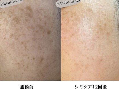 エステティック ハンズ(esthetic hands)の写真