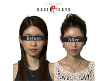ネオオアシストウキョウ(ネオ OASIS TOKYO)の雰囲気（美容整形なしの小顔術【小顔/小顔矯正/美容鍼】）
