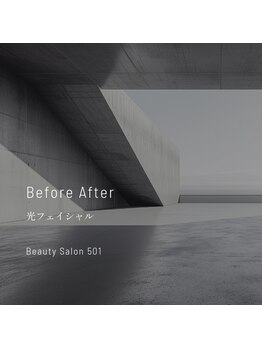 ゴーマルイチ(501)/光フェイシャル Before/After