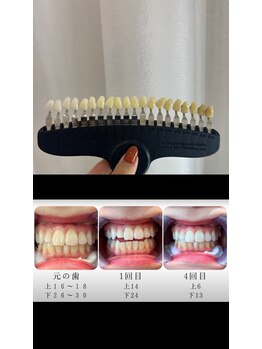 エクシアホワイトニング 西条店/