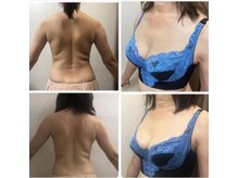 美人バスト 本厚木店の雰囲気(【実績30,000人以上】バストアップとダイエットを同時に叶える!)