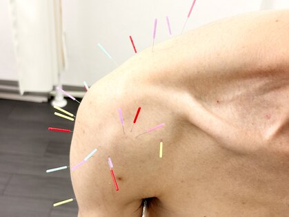 とだ鍼灸院の写真