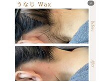 ソワン ボーテ(Soin Beaute)/ワックス脱毛