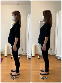 クルミ(Kurumi)/マタニティ整体の効果!