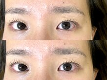 シエンテ(Ciente)/奥二重さん