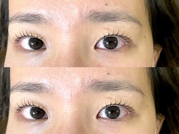 シエンテ(Ciente)/奥二重さん