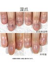20代/深爪/半年後アフター
