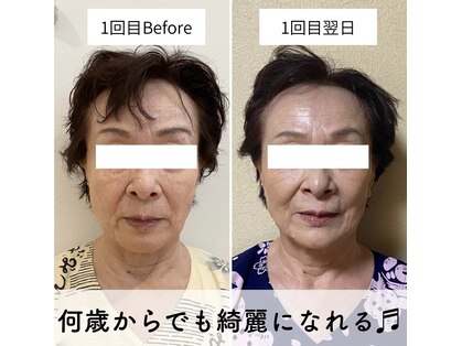 ハレトケ(HARE TO KE)の写真