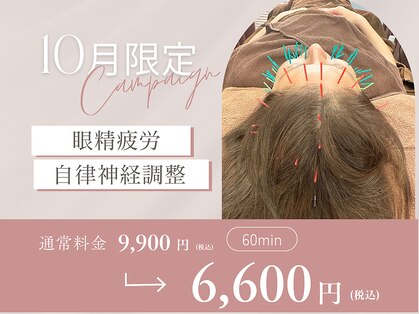 アイ(i)の写真