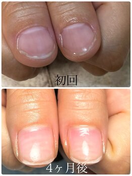 ファーストステップサロン(First.step.salon)/自爪育成ルミナジェル使用！