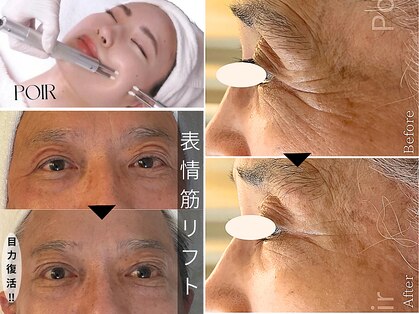 ポ ワール(Poir)の写真