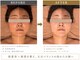 ヴィ ボーテ(Vie beaute)の写真/【当日予約承ります】他店で納得できなかった方へ。繊細な技術で理想の小顔を目指す圧倒的な効果実感◎