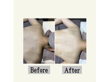 ペールノエル 富士店(PERENOEL)/フォトエステ(20代女性)