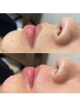 ラ フルール(La Fleur)/口周りワックス