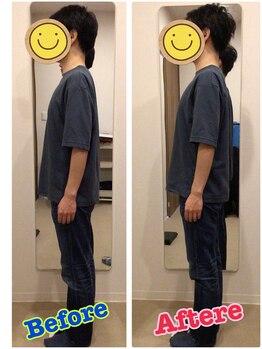 うちんだい整骨院 整体院/20代男性/猫背矯正 施術事例