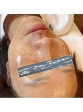 エクスクラメーションマーク(!!!)/水光人工皮膜