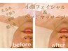 【小顔フェイシャル】しわケア・たるみケア　フェイスライン引き締め！