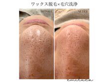 エミルカ(EMILUCA)の雰囲気（毛穴洗浄メニュー大人気です★）
