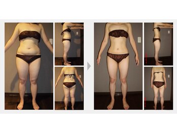 Nビューティー/最新エンダモロジーBODY