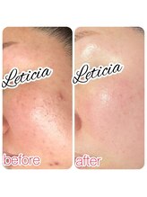 レティシア(Leticia)/◇ララピール◇